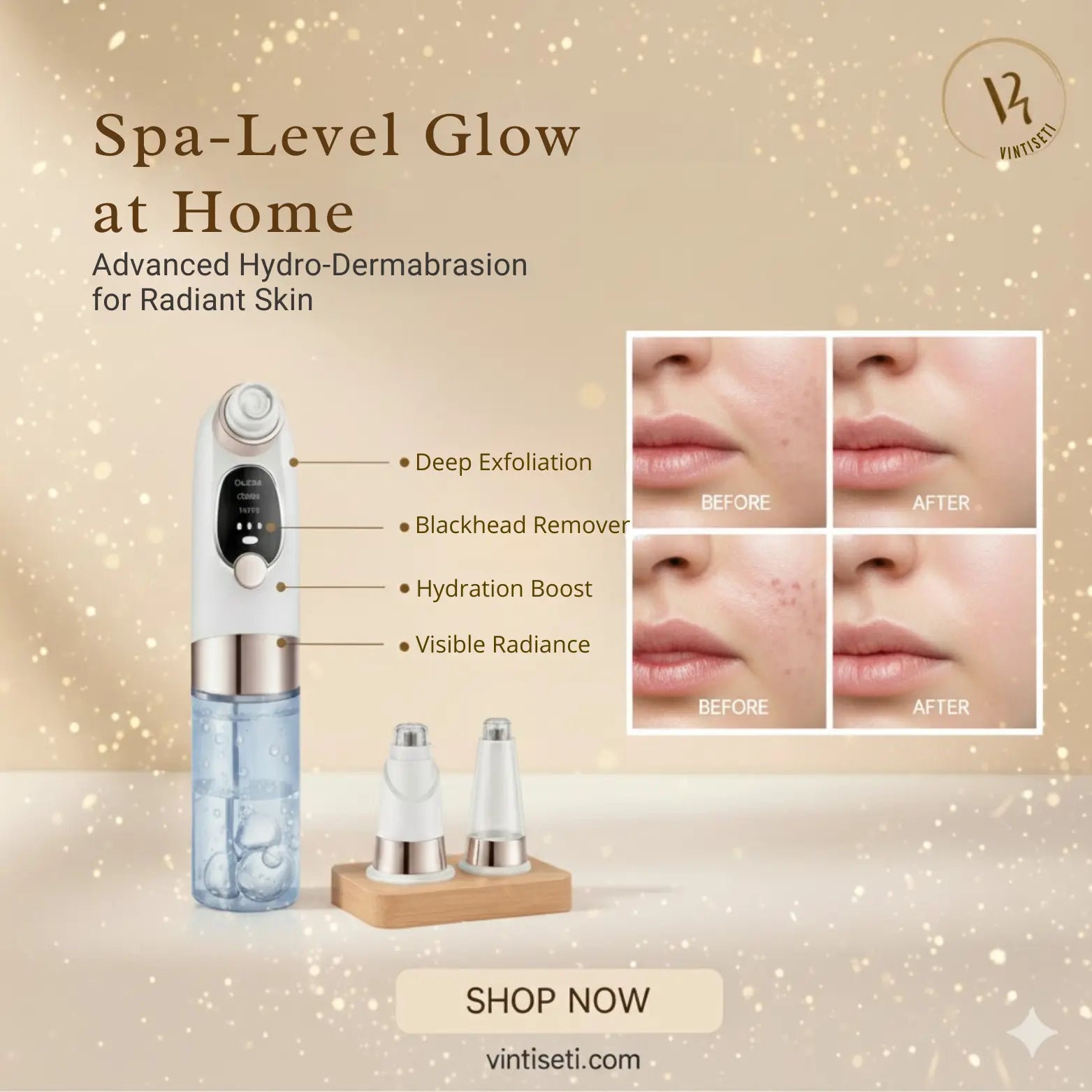 Vintiseti™ Hydro Pore Cleaner Vintiseti Aura